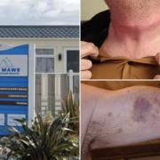 L: Ty Mawr Holiday Park, Towyn. R: Injuries Mr Allford said he sustained from the attack
